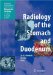  Radiology of the Stomach and Duodenum
