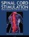  Spinal Cord Stimulation: Percutaneous Implantation Techniques