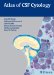 Atlas of CSF Cytology