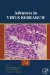  Viral Hemorrhagic Fevers and Other Emerging Infections