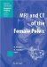  MRI and CT of the Female Pelvis