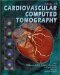  Atlas of Cardiovascular Computed Tomography