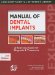  Lexi-Comp's Manual of Dental Implants: A Reference Guide for Diagnosis & Treatment