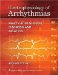  Electrophysiology of Arrhythmias: Practical Images for Diagnosis and Ablation