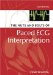 The Nuts and Bolts of Paced ECG Interpretation