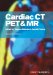  Cardiac Ct, Pet and Mr